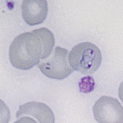 File:Bab complex 2.jpg - MalariaETC