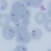 Many parisite containing red cells, note the marked variability of form