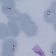 Double dot forms may be seen