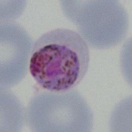 Plasmodium malariae: Morphology - MalariaETC