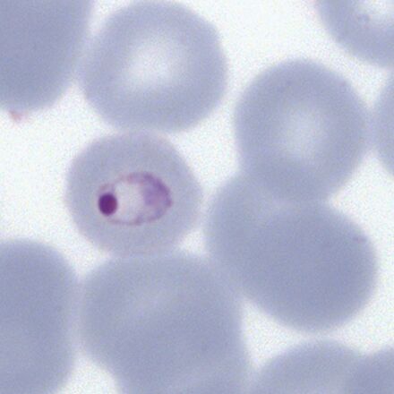 Plasmodium malariae: Morphology - MalariaETC