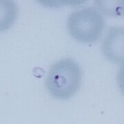 Free parasite lying outside of erythrocyte