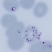 Elongated gametocyte curved form